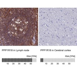 PPP1R18 Antibody, Novus Biologicals:Antibodies:Primary Antibodies